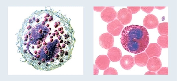 
        Лейкоцитоз. Как правильно сдать анализ крови и расшифровать результат? 			    