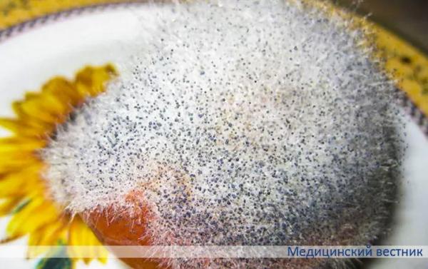 Плесневые грибы и опасность инвазивных микозов		 
			Плесневые грибы и опасность инвазивных микозов