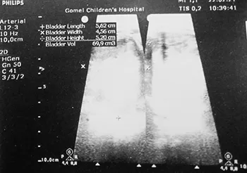 Нейрогенный мочевой пузырь		 
			Нейрогенный мочевой пузырь