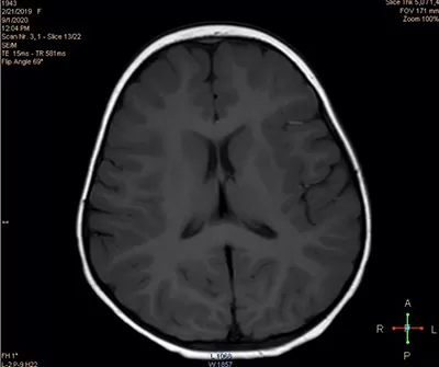 
			Пароксизмальные состояния у детей неэпилептического характера		