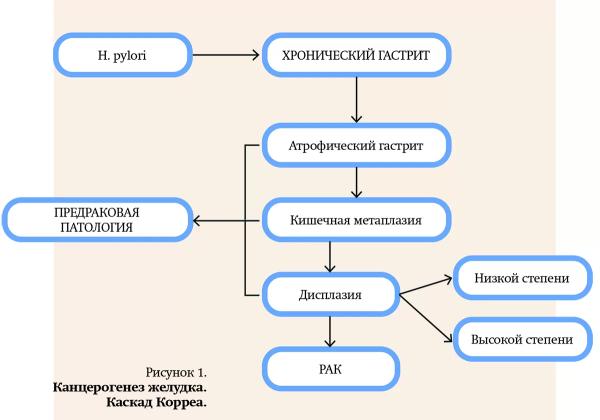 Природа хронической гастродуоденальной боли. Часть 1		 
			Природа хронической гастродуоденальной боли. Часть 1
