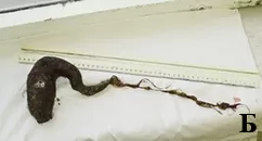 Халитоз: от симптома к диагнозу и терапии		 
			Халитоз: от симптома к диагнозу и терапии