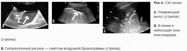 УЗИ легких у пациентов с CoViD-19: опыт китайских специалистов. Часть 1		 
			УЗИ легких у пациентов с CoViD-19: опыт китайских специалистов. Часть 1