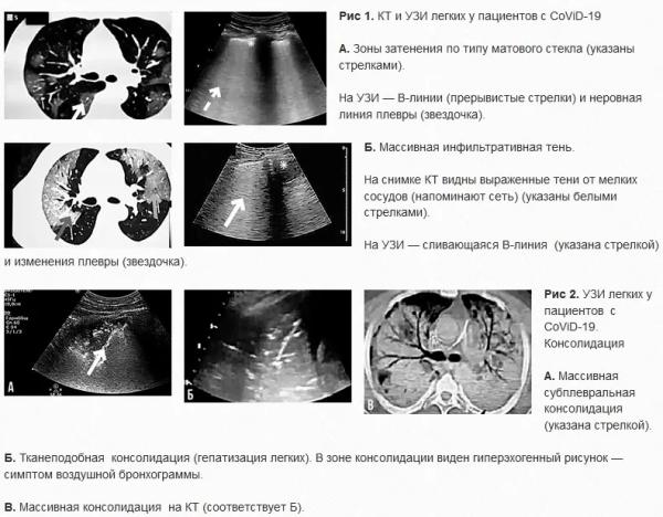 УЗИ легких у пациентов с CoViD-19: опыт китайских специалистов. Часть 1		 
			УЗИ легких у пациентов с CoViD-19: опыт китайских специалистов. Часть 1