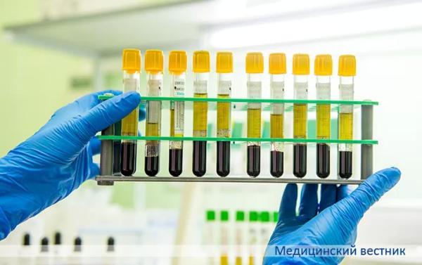 
			Как избежать ошибок на преаналитическом этапе		