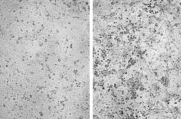 Эффективность бустера «Спутник Лайт» против варианта «омикрон»		 
			Эффективность бустера «Спутник Лайт» против варианта «омикрон»