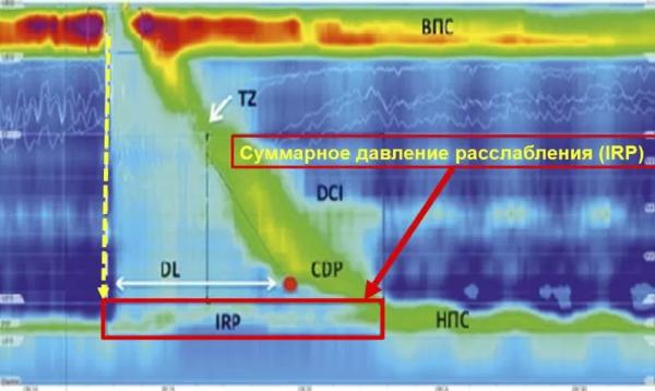 Манометрия пищевода высокого разрешения		 
			Манометрия пищевода высокого разрешения