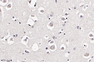 Патоморфологические изменения головного мозга при COVID-19
Патоморфологические изменения головного мозга при COVID-19