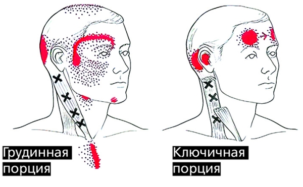 «Замороженные в мышцах чувства»: как связаны тревога, депрессия и боль?		 
			«Замороженные в мышцах чувства»: как связаны тревога, депрессия и боль?