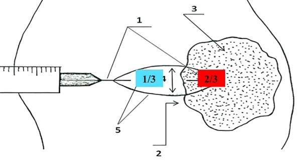 Патогистологическое сопровождение при диагностике заболеваний		 
			Патогистологическое сопровождение при диагностике заболеваний