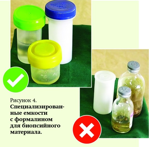 Патогистологическое сопровождение при диагностике заболеваний		 
			Патогистологическое сопровождение при диагностике заболеваний