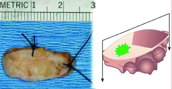 Патогистологическое сопровождение при диагностике заболеваний		 
			Патогистологическое сопровождение при диагностике заболеваний