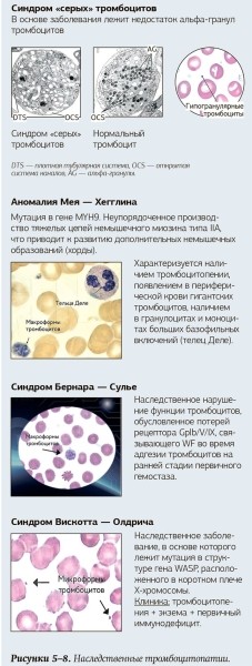Тромбоцитоз и тромбоцитопения: диагностический поиск 			     
        Тромбоцитоз и тромбоцитопения: диагностический поиск