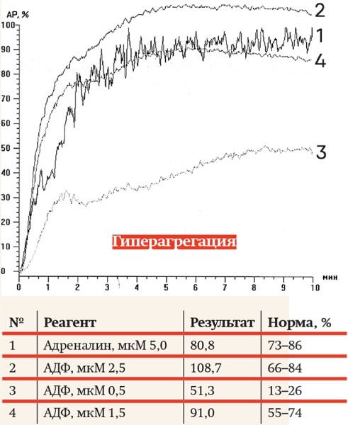 
        Агрегатометрия: нюансы прочтения анализов			    