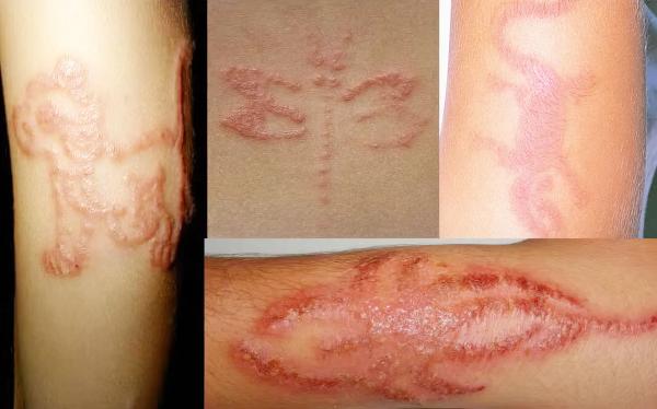 
        Зудящие дерматозы у детей: клиническая симптоматика и тактика лечения			    