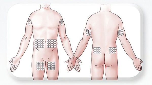 Заместительная терапия препаратами иммуноглобулина для подкожного введения у пациентов детского возраста с ПИД                      
        Заместительная терапия препаратами иммуноглобулина для подкожного введения у пациентов детского возраста с ПИД