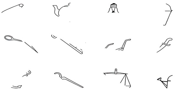 Распознать вовремя. Ранняя диагностика болезни Альцгеймера                     
        Распознать вовремя. Ранняя диагностика болезни Альцгеймера