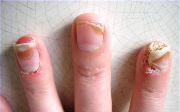 Ногти: клинико-диагностическая значимость в практике дерматолога + аудио                
        
         
        Ногти: клинико-диагностическая значимость в практике дерматолога + аудио