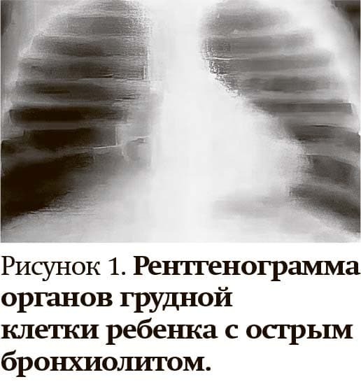 Кашель у детей: особенности дифференциальной диагностики                     
        Кашель у детей: особенности дифференциальной диагностики