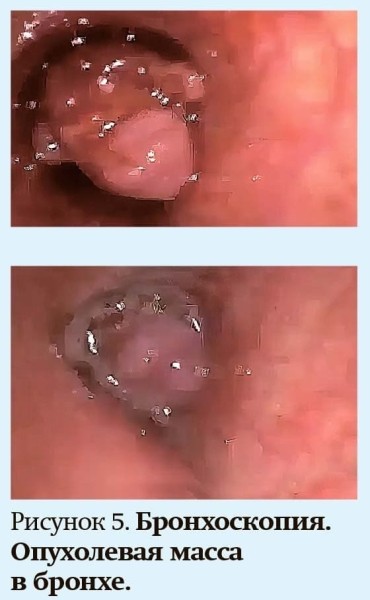 Кашель у детей: особенности дифференциальной диагностики                     
        Кашель у детей: особенности дифференциальной диагностики