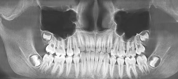 
        Надо ли удалять «восьмерки»? Как принять обоснованное решение                    