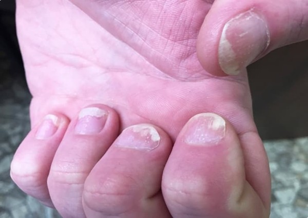 Ногти: клинико-диагностическая значимость в практике дерматолога + аудио                
        
         
        Ногти: клинико-диагностическая значимость в практике дерматолога + аудио