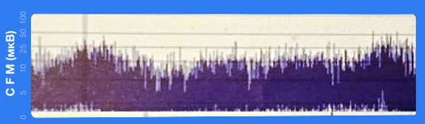 Терапевтическая гипотермия в неонатологии		 
			Терапевтическая гипотермия в неонатологии