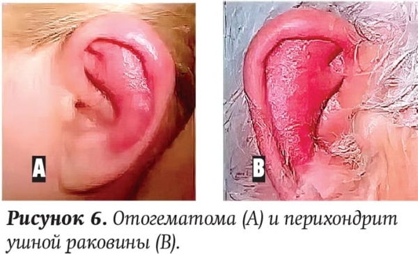 
        Ребенок с лор-патологией на приеме у ВОП и педиатра + аудио			
        
        