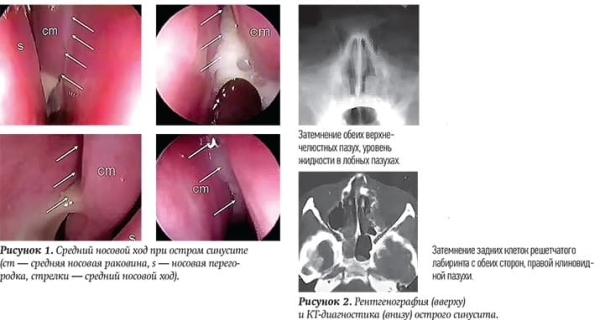 
        Ребенок с лор-патологией на приеме у ВОП и педиатра + аудио			
        
        