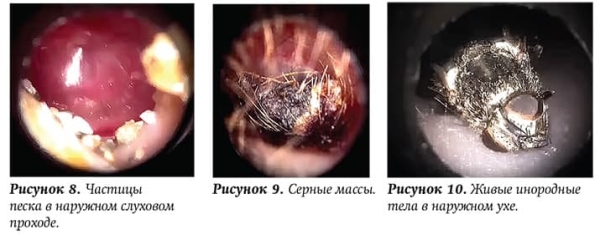 
        Ребенок с лор-патологией на приеме у ВОП и педиатра + аудио			
        
        