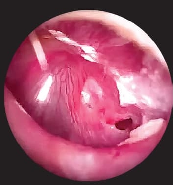 
        Ребенок с лор-патологией на приеме у ВОП и педиатра + аудио			
        
        