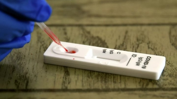 Минздрав разъяснил, как пользоваться экспресс-тестами на антитела Минздрав разъяснил, как пользоваться экспресс-тестами на антитела